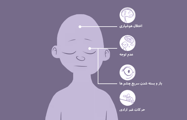 علائم بیماری صرع ابسنس